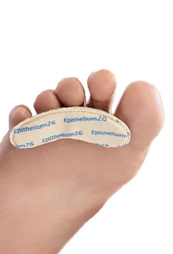 Barrettes sous-diaphysaires