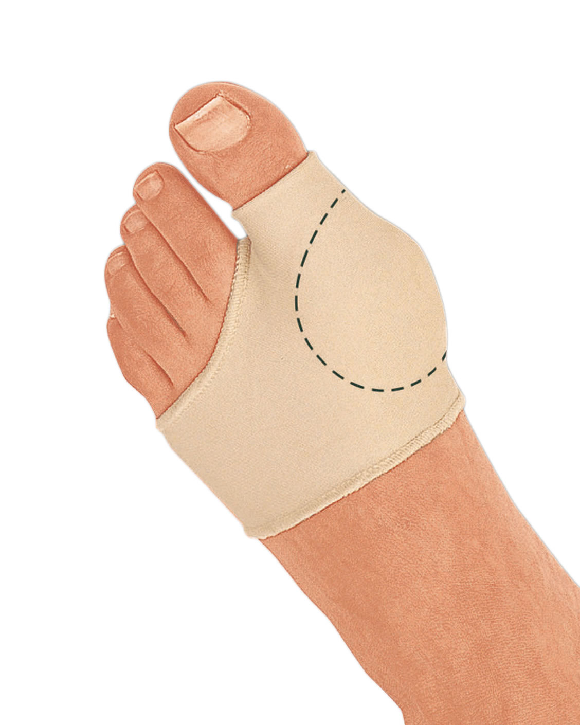 Protection hallux valgus Epitact®