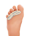 Paire de barrettes sous-diaphysaires Epitact®